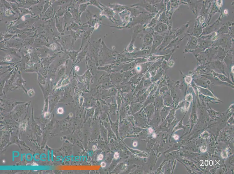 IBRS-2 [IB-RS-2] Cell Complete Medium - small - 6