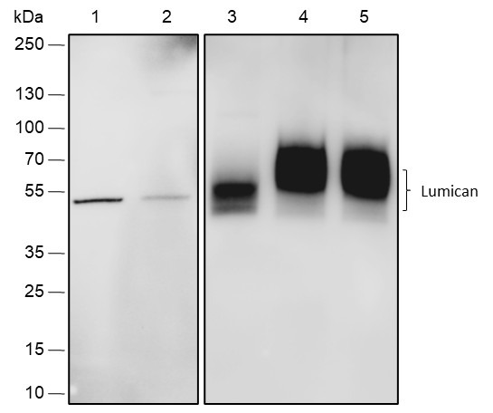 Recombinant Lumican Monoclonal Antibody-searchlist-1