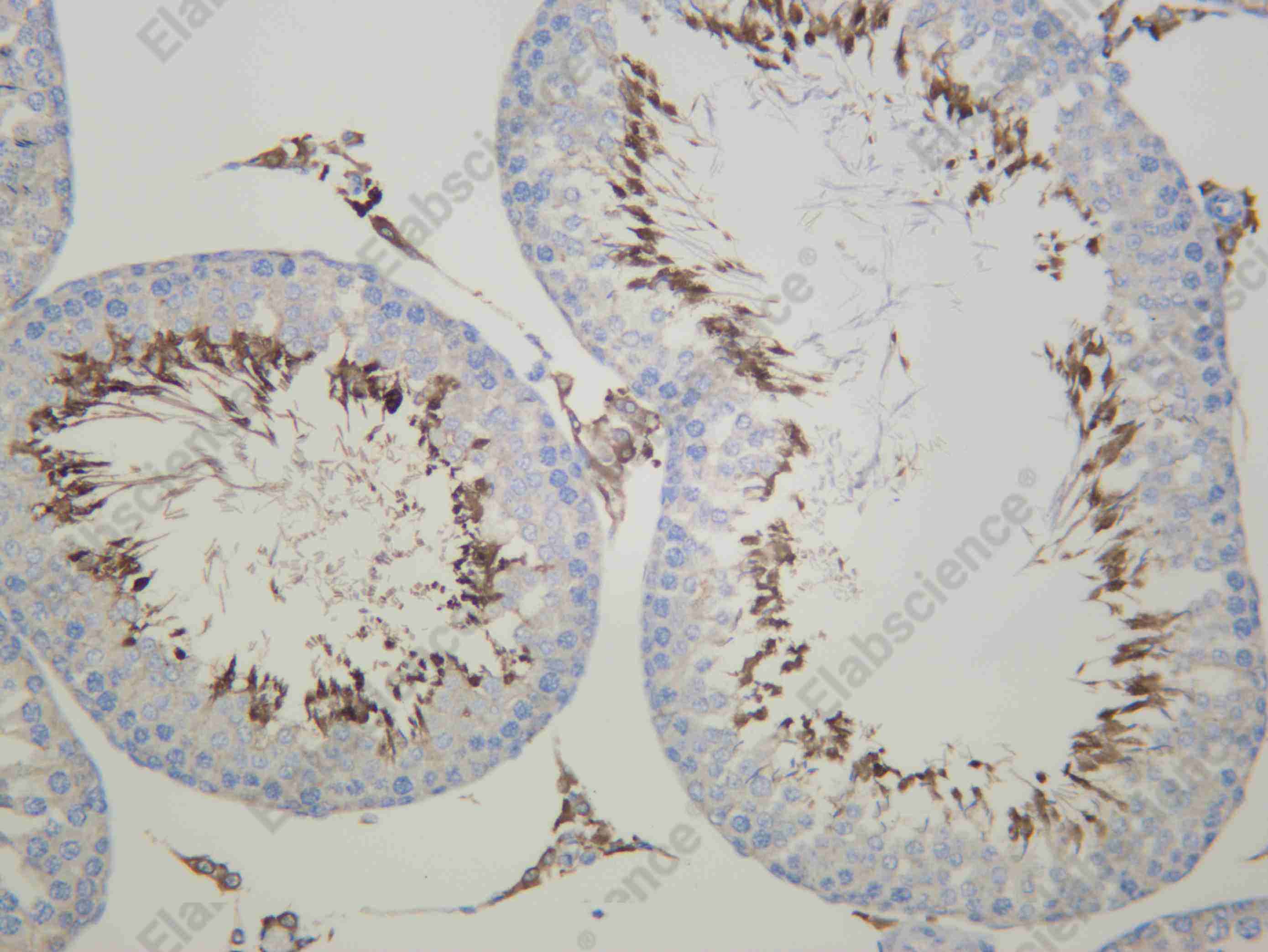 Recombinant CENPE Monoclonal Antibody - 1