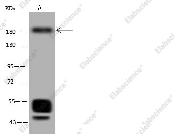 c-MET Monoclonal Antibody - 1