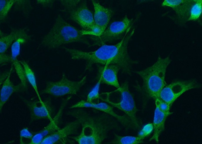 Doublecortin/DCX Monoclonal Antibody - small - 1