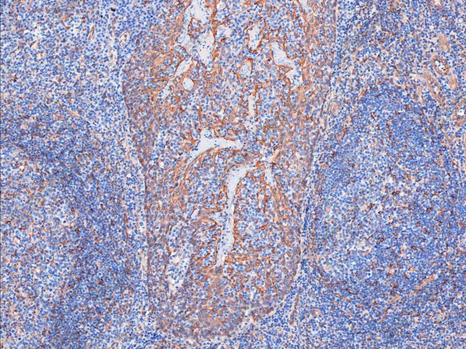 Recombinant TMEM173 Monoclonal Antibody - 1