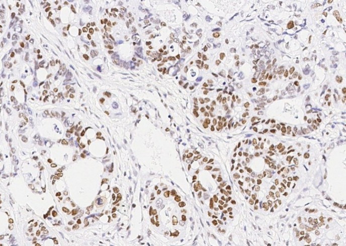 Recombinant MSH6/GTBP Monoclonal Antibody - small - 2