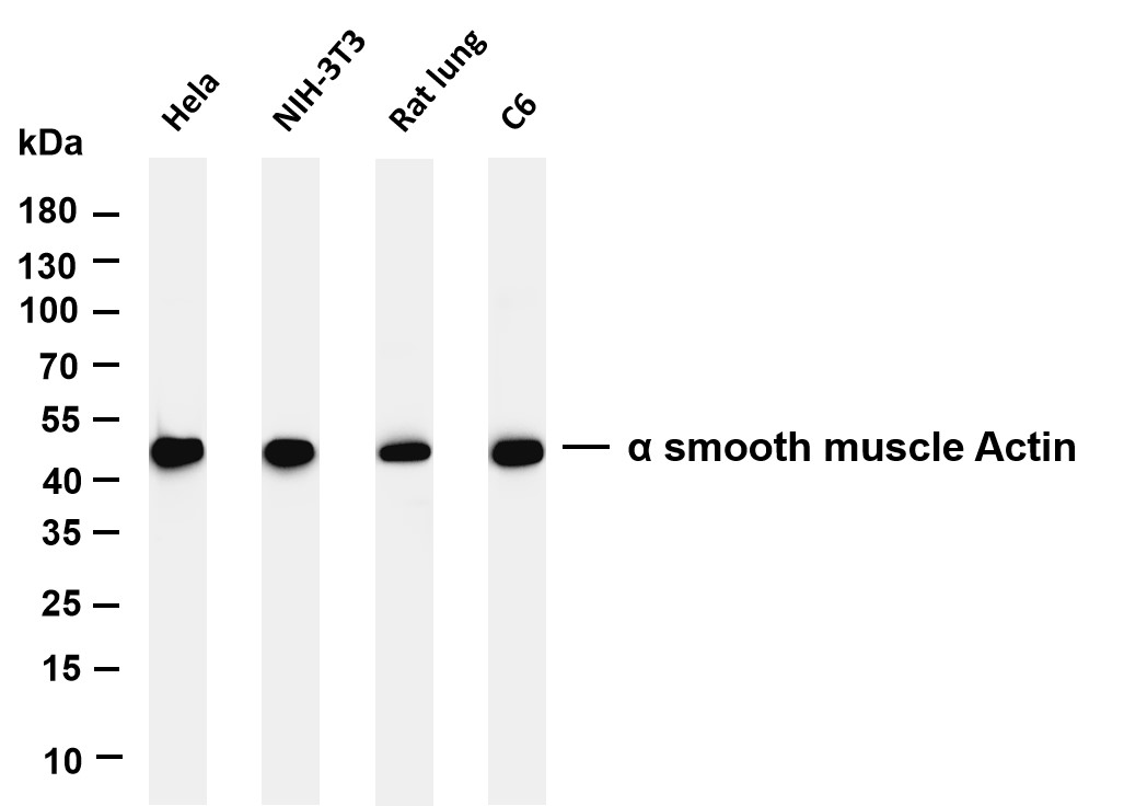 Recombinant α smooth muscle actin Monoclonal Antibody - 3