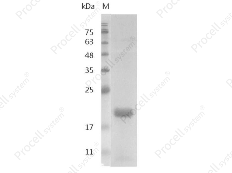 IL-1&beta;/IL1B1/IL1B, Swine, Recombinant