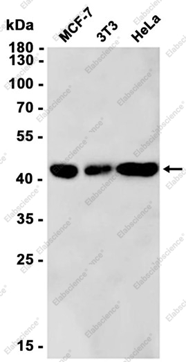 Recombinant PCYT1A Monoclonal Antibody - 1