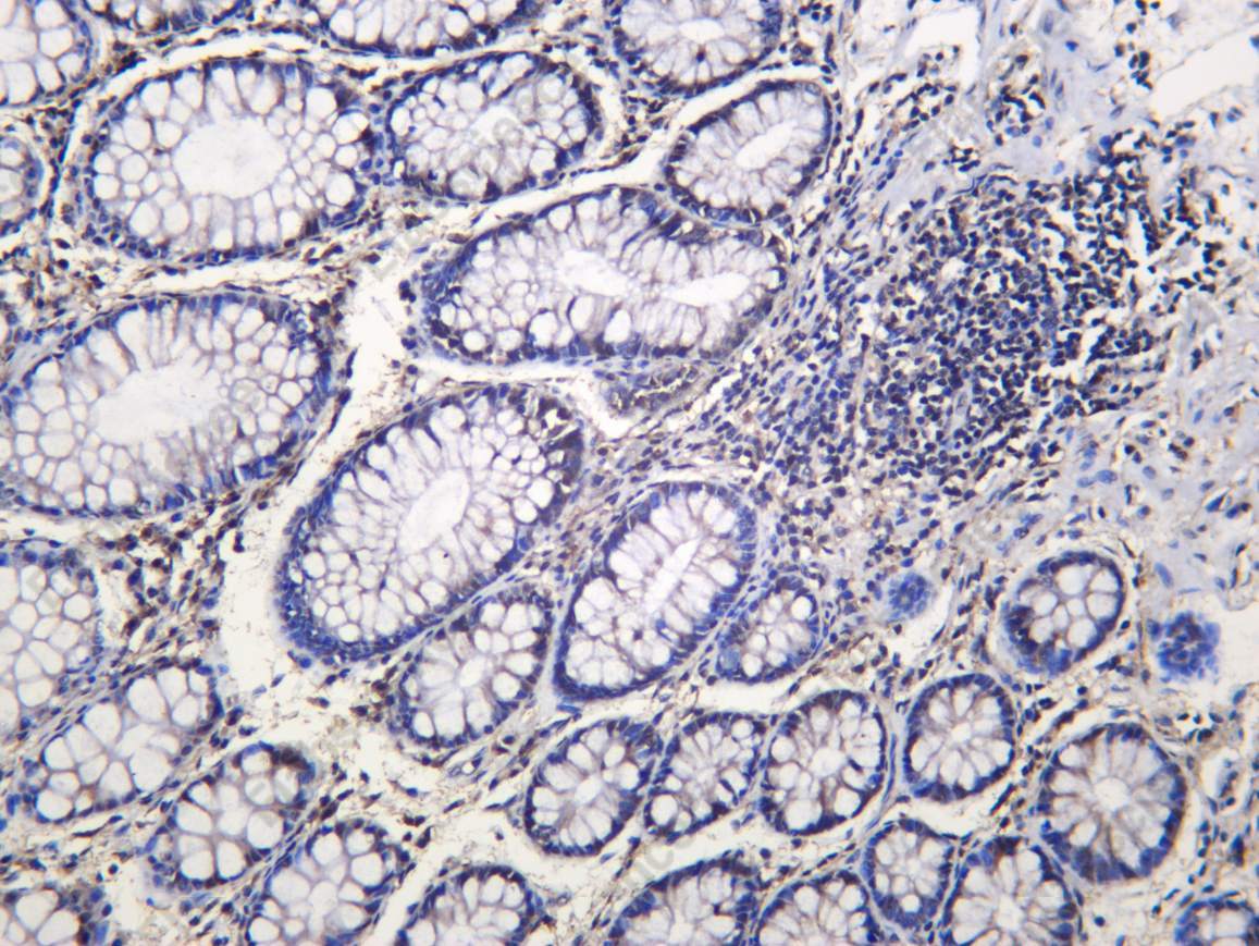 Recombinant Dyskerin Monoclonal Antibody - 1