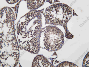 Recombinant PTTG1 Monoclonal Antibody - 3