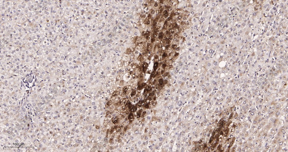 Recombinant Glutamine Synthetase Monoclonal Antibody - 2