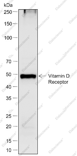 Recombinant Vitamin D Receptor Monoclonal Antibody - 2