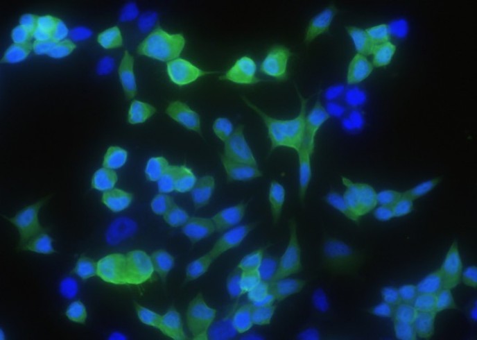 Recombinant CRABP2 Monoclonal Antibody - small - 2