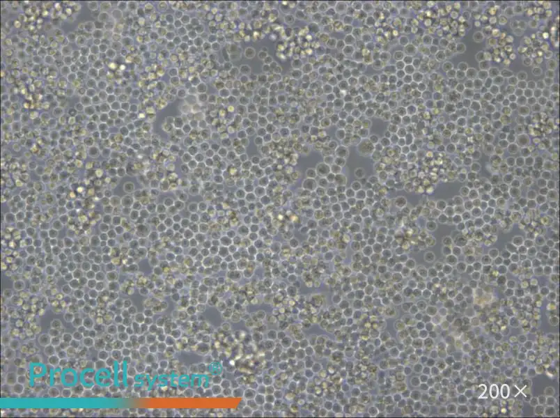 DoHH2 Cell Complete Medium - 6