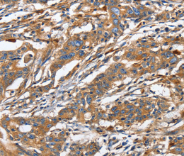 GNA13 Polyclonal Antibody - 3