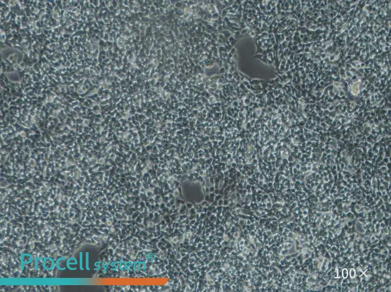 A-673 Cell Complete Medium - 3