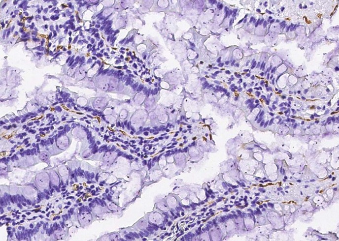 Recombinant CD36/SCARB3 Monoclonal Antibody-searchlist-1