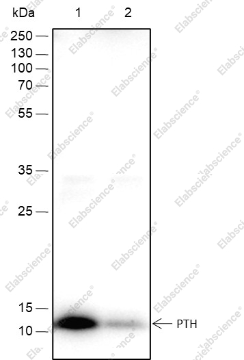 Recombinant PTH Monoclonal Antibody - 1