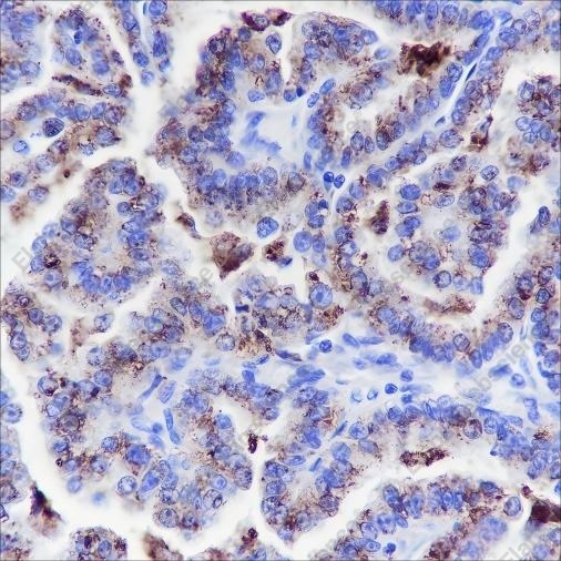 Recombinant Napsin A Monoclonal Antibody - 2
