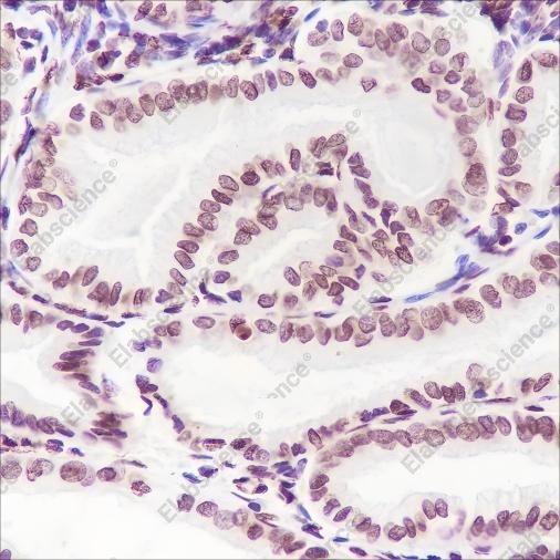 Recombinant Phospho-Cyclin D1 (Thr286) Monoclonal Antibody - 2