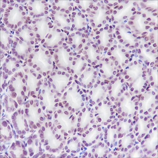 Recombinant HMGB1 Monoclonal Antibody - small - 3