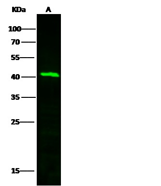 Recombinant TFPI/LACI/EPI Monoclonal Antibody - small - 2