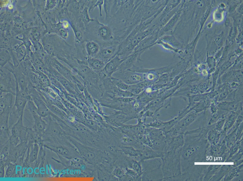 Mouse Colonic Smooth Muscle Cell Complete Medium - small - 6