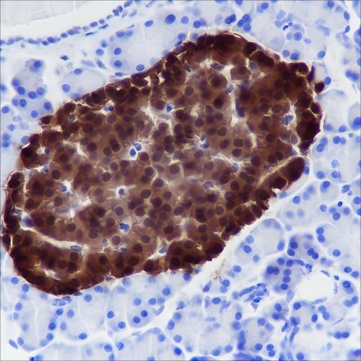 Recombinant SCGN Monoclonal Antibody - 3