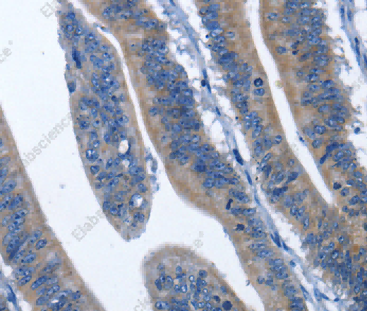 HSF27 Polyclonal Antibody - 3