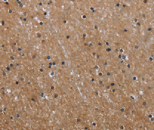 GAB2 Polyclonal Antibody - 3