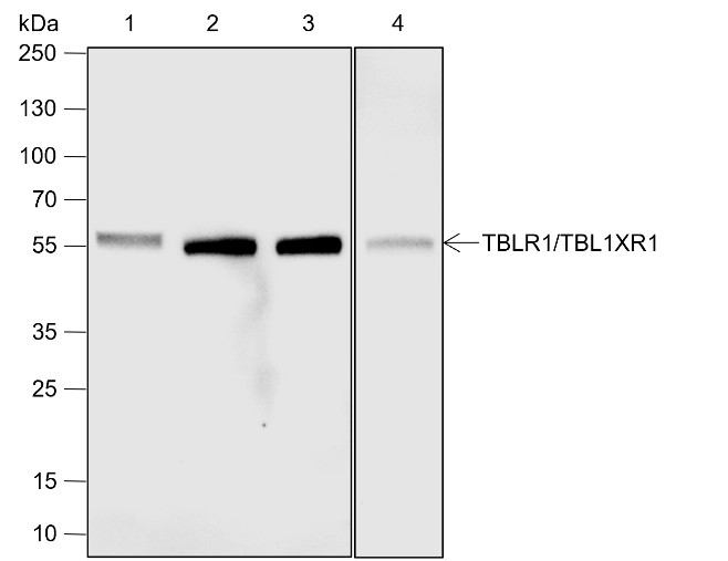 Recombinant TBLR1/TBL1XR1 Monoclonal Antibody-searchlist-1