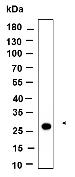 Recombinant CTRP2 Monoclonal Antibody-searchlist-1