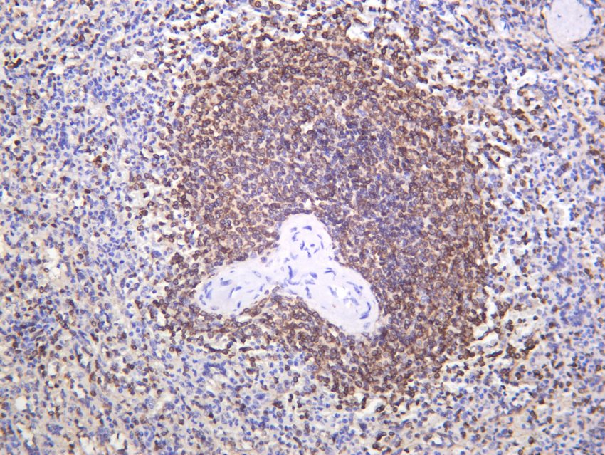 Recombinant Bcl-2 Monoclonal Antibody - small - 8