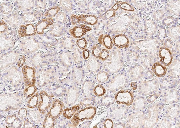 Recombinant Osteopontin/SPP1/ETA-1 Monoclonal Antibody - small - 2