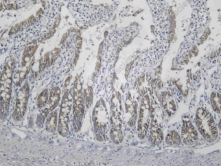 Recombinant IGF2-BP2 Monoclonal Antibody - 3