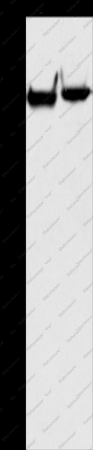 MARK1 Polyclonal Antibody - 1