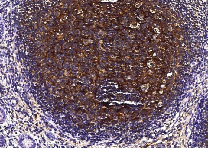 Recombinant Clusterin/Apolipoprotein J/Apo-J/CLU Monoclonal Antibody - small - 3
