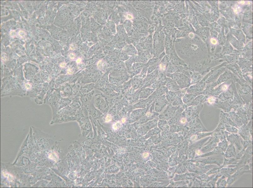 TTA1 Cell Complete Medium - 5