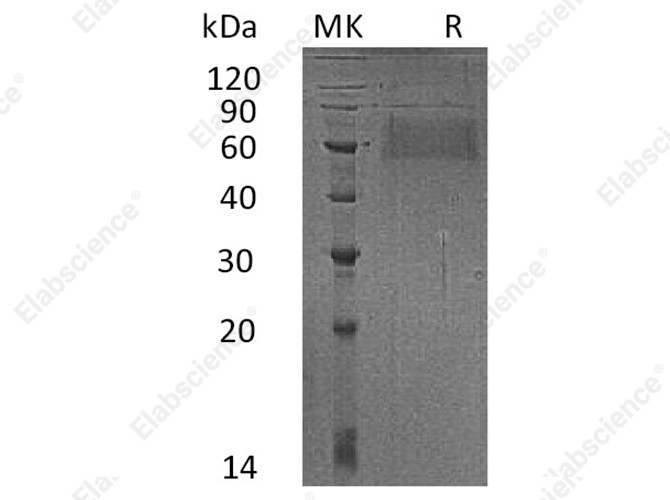 Recombinant Human SELL Protein (His Tag) - 1
