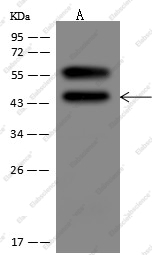 SerpinB3 Monoclonal Antibody - 1
