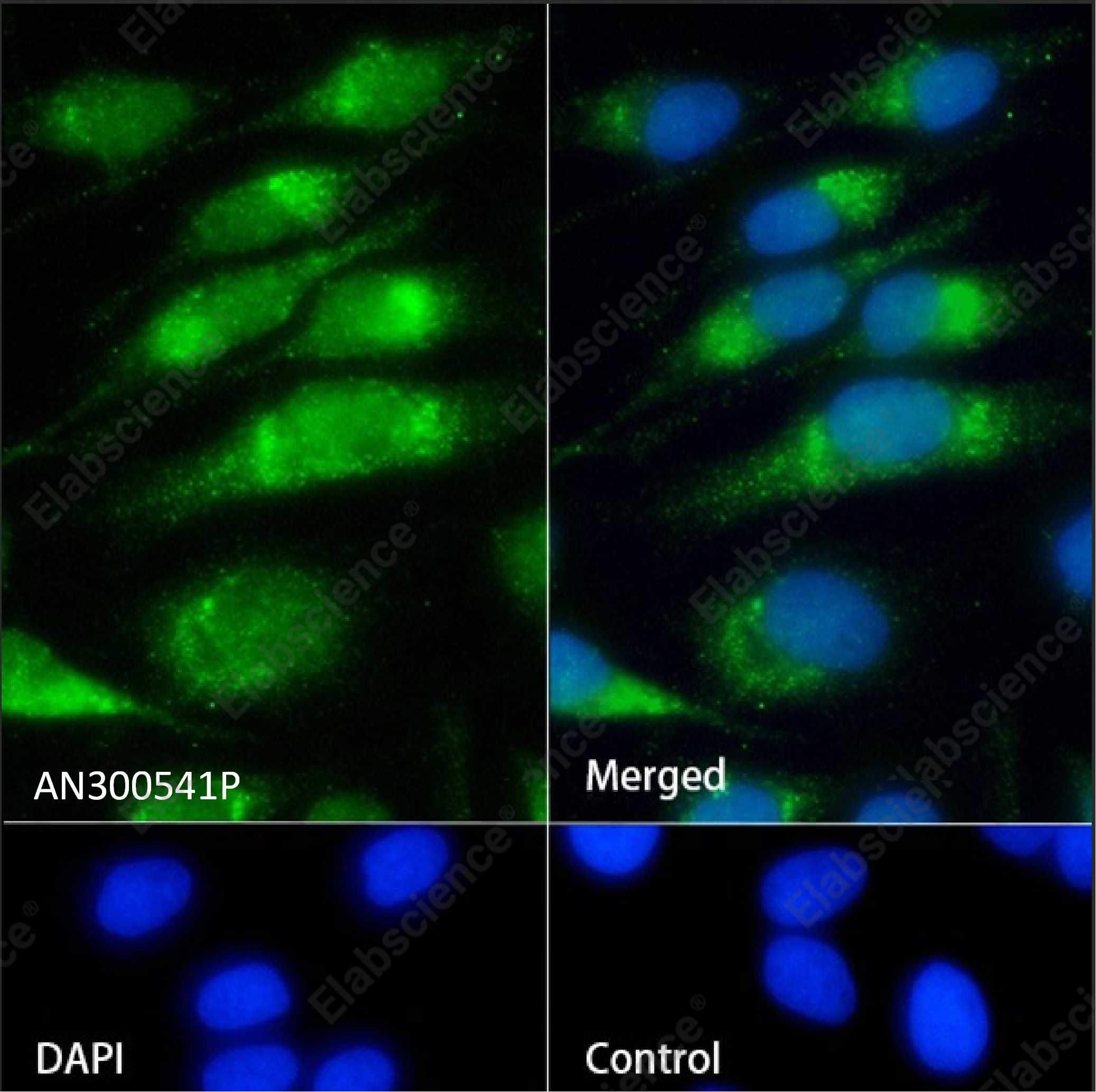 Recombinant P4HB Monoclonal Antibody - 2