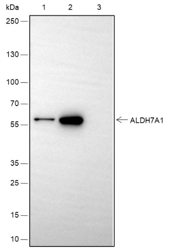 Recombinant ALDH7A1 Monoclonal Antibody - small - 9