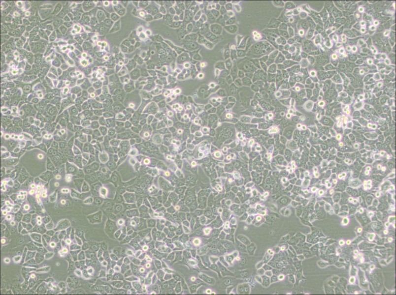 NCI-H2126 Cell Complete Medium - 2