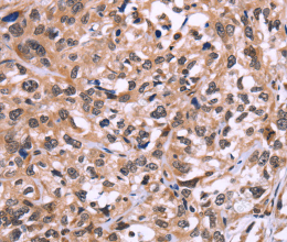 AMIGO2 Polyclonal Antibody - 2