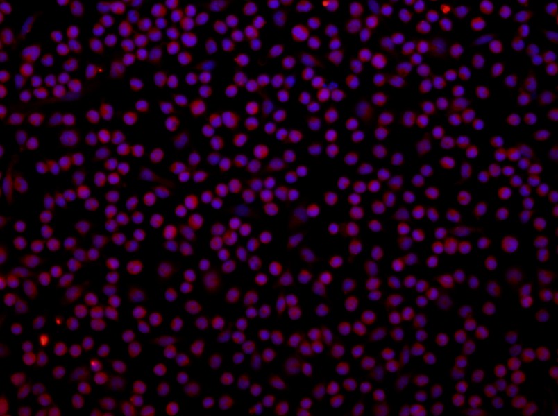 Rat Peritoneal Macrophage Complete Medium - 2