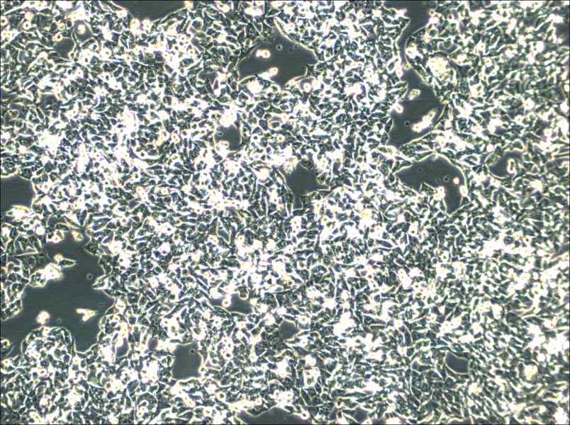 SK-CO-1 Cell Complete Medium - small - 2