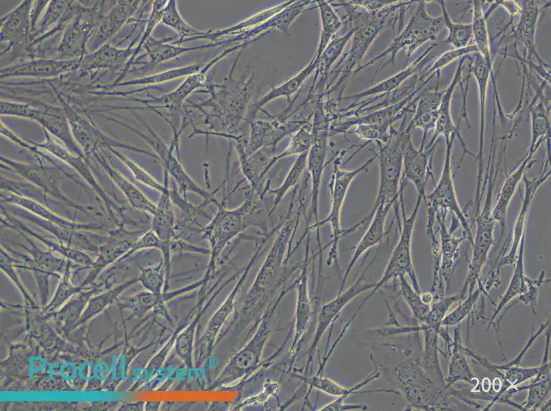 OP9 Cell Complete Medium - 5