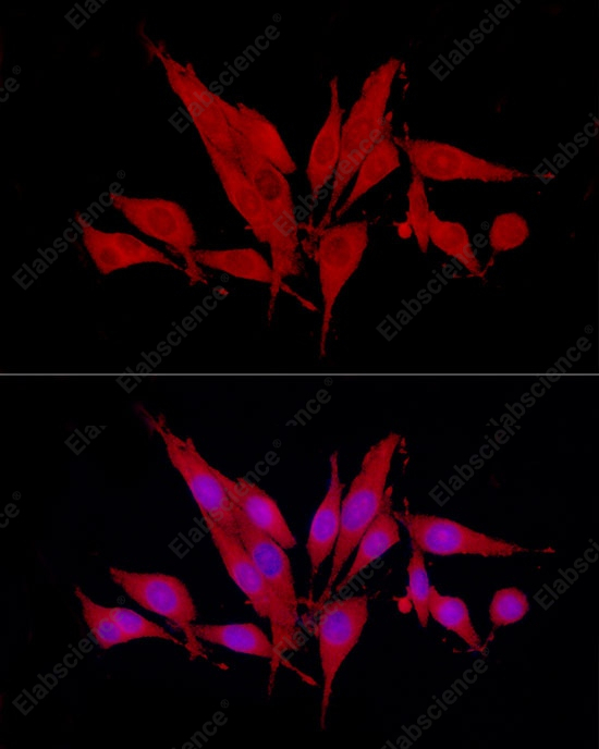 SIRT2 Polyclonal Antibody - 3