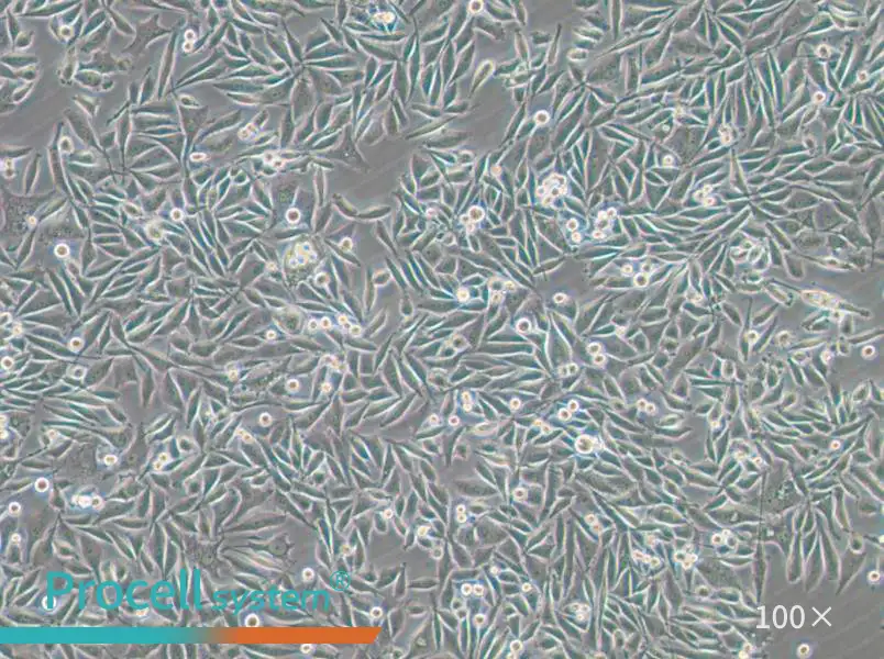 PC-3-GFP Cell Complete Medium - small - 5