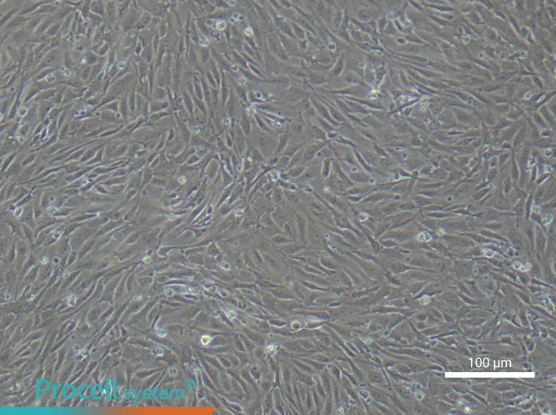 Human Lymphatic Endothelial Cell Complete Medium - 1