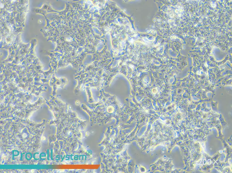 LS 174T [LS174T] Cell Complete Medium - small - 6