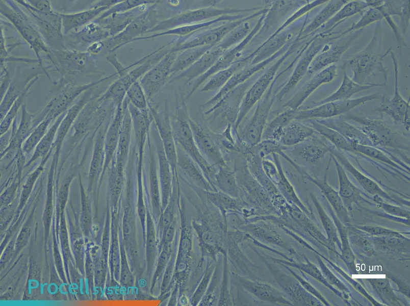 Human Esophageal Smooth Muscle Cell Complete Medium - 6